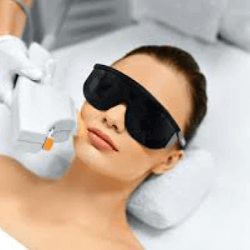 Fractional CO2 Laser